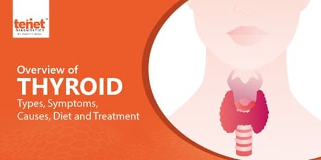 Thyroid - Types, Symptoms, Causes, Diet and Treatment