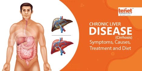 Cirrhosis - Symptoms, Causes,  Treatment And Diet